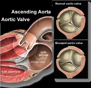aorta_cross_structure
