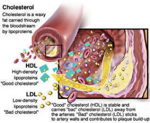 cholesterol