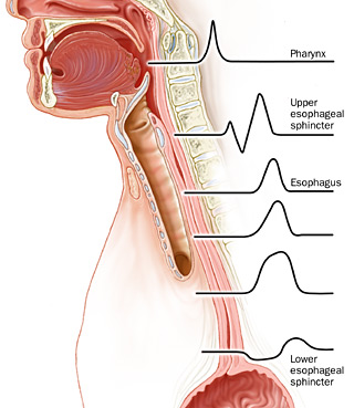 esophageal manometry