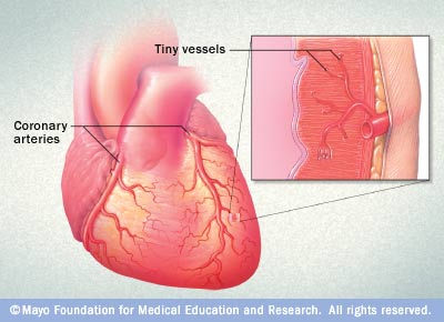 heart-small-vessel-disease