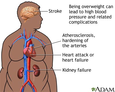 obesity-and-health-picture