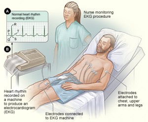 EKG